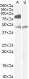 Zinc Finger DHHC-Type Containing 8 antibody, PA5-18664, Invitrogen Antibodies, Western Blot image 