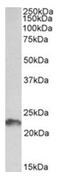 LIF Interleukin 6 Family Cytokine antibody, AP32068PU-N, Origene, Western Blot image 