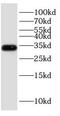 Esterase D antibody, FNab02862, FineTest, Western Blot image 