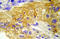 EGFR antibody, AP20975PU-N, Origene, Immunohistochemistry paraffin image 