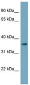 Phosphatidate cytidylyltransferase, mitochondrial antibody, TA342496, Origene, Western Blot image 