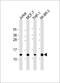 40S ribosomal protein S27 antibody, M06699, Boster Biological Technology, Western Blot image 