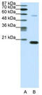 Chromobox 3 antibody, TA338109, Origene, Western Blot image 