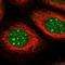 Fatty Acid Binding Protein 12 antibody, NBP1-93537, Novus Biologicals, Immunofluorescence image 