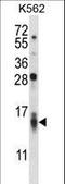 C-C Motif Chemokine Ligand 15 antibody, LS-C168449, Lifespan Biosciences, Western Blot image 