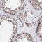 Coiled-Coil Domain Containing 77 antibody, PA5-58566, Invitrogen Antibodies, Immunohistochemistry frozen image 