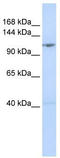 DEAD-Box Helicase 46 antibody, TA341593, Origene, Western Blot image 