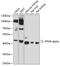 Peroxisome Proliferator Activated Receptor Alpha antibody, 22-414, ProSci, Western Blot image 