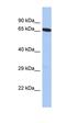 Putative polypeptide N-acetylgalactosaminyltransferase-like protein 5 antibody, orb325565, Biorbyt, Western Blot image 