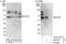 ETV6 antibody, A303-674A, Bethyl Labs, Western Blot image 