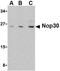 Nucleolar protein 3 antibody, NBP1-76460, Novus Biologicals, Western Blot image 