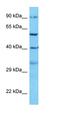 ST8 Alpha-N-Acetyl-Neuraminide Alpha-2,8-Sialyltransferase 2 antibody, orb325289, Biorbyt, Western Blot image 