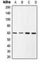 SRC Proto-Oncogene, Non-Receptor Tyrosine Kinase antibody, orb214605, Biorbyt, Western Blot image 