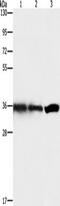 G Protein Subunit Beta 1 antibody, TA349322, Origene, Western Blot image 