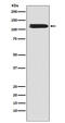 Solute Carrier Family 8 Member A1 antibody, M03876, Boster Biological Technology, Western Blot image 