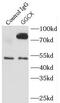 Gamma-Glutamyl Carboxylase antibody, FNab03444, FineTest, Immunoprecipitation image 