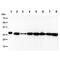 Phosphoglycerate Mutase 2 antibody, GTX57652, GeneTex, Western Blot image 