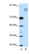 SPIN antibody, 27-438, ProSci, Western Blot image 