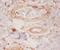 Rho GDP-dissociation inhibitor 1 antibody, A52636-100, Epigentek, Immunohistochemistry paraffin image 