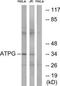 ATP Synthase F1 Subunit Gamma antibody, TA312717, Origene, Western Blot image 