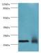 Neuronal Calcium Sensor 1 antibody, LS-C375735, Lifespan Biosciences, Western Blot image 