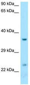 D-Aminoacyl-TRNA Deacylase 1 antibody, TA337930, Origene, Western Blot image 
