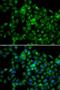Probable N-acetyltransferase 8B antibody, LS-C346281, Lifespan Biosciences, Immunofluorescence image 