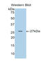 Pappalysin-1 antibody, LS-C296022, Lifespan Biosciences, Western Blot image 