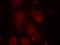 LIM domain kinase 1 antibody, orb14846, Biorbyt, Immunofluorescence image 