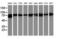 Catenin Beta 1 antibody, LS-C172584, Lifespan Biosciences, Western Blot image 
