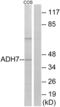 Alcohol Dehydrogenase 7 (Class IV), Mu Or Sigma Polypeptide antibody, abx014164, Abbexa, Western Blot image 