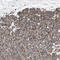 Zinc Finger DHHC-Type Containing 5 antibody, HPA014670, Atlas Antibodies, Immunohistochemistry frozen image 