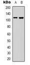 Collagen Type XIX Alpha 1 Chain antibody, LS-C368674, Lifespan Biosciences, Western Blot image 