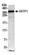 Death-inducer obliterator 1 antibody, A300-152A, Bethyl Labs, Western Blot image 