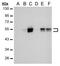 Carbonic Anhydrase 9 antibody, MA5-16318, Invitrogen Antibodies, Western Blot image 