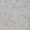 PHD Finger Protein 1 antibody, A03758-1, Boster Biological Technology, Immunohistochemistry paraffin image 