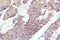 Mitogen-Activated Protein Kinase Kinase Kinase 5 antibody, LS-C178120, Lifespan Biosciences, Immunohistochemistry frozen image 
