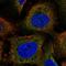 Rho/Rac Guanine Nucleotide Exchange Factor 18 antibody, HPA071867, Atlas Antibodies, Immunocytochemistry image 