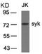 Spleen Associated Tyrosine Kinase antibody, AP08103PU-N, Origene, Western Blot image 