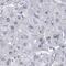 SSX Family Member 2B antibody, HPA045683, Atlas Antibodies, Immunohistochemistry frozen image 