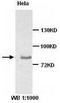 Zyxin antibody, TA310137, Origene, Western Blot image 