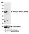 Replication Protein A2 antibody, NBP1-23017, Novus Biologicals, Western Blot image 