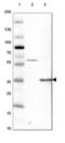 GATA Zinc Finger Domain Containing 1 antibody, NBP1-92219, Novus Biologicals, Western Blot image 