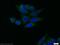 RB1 Inducible Coiled-Coil 1 antibody, 10069-1-AP, Proteintech Group, Immunofluorescence image 