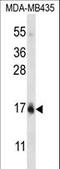 Histone H2B type 1-C/E/G antibody, LS-C203666, Lifespan Biosciences, Western Blot image 