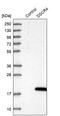 Down syndrome critical region protein 4 antibody, PA5-53807, Invitrogen Antibodies, Western Blot image 