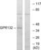 Probable G-protein coupled receptor 132 antibody, LS-C199008, Lifespan Biosciences, Western Blot image 