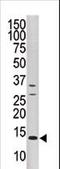 Dual Specificity Phosphatase 15 antibody, LS-C101047, Lifespan Biosciences, Western Blot image 