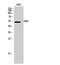STK38L antibody, A06774-1, Boster Biological Technology, Western Blot image 