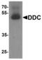 Aromatic-L-amino-acid decarboxylase antibody, LS-B10123, Lifespan Biosciences, Western Blot image 